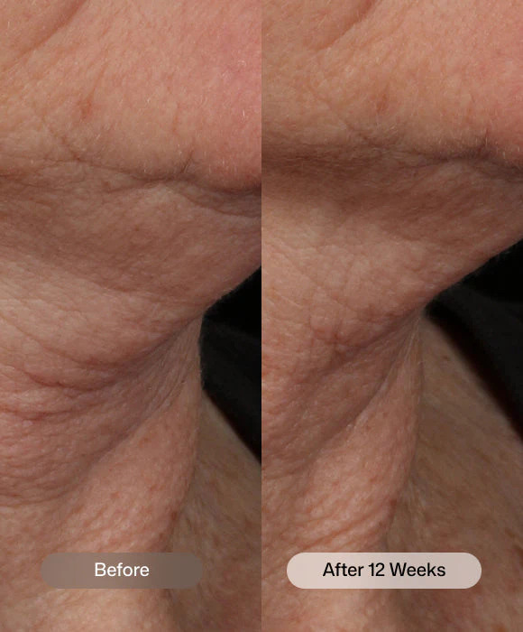 Nectifirm® Advanced - Image 5